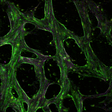 Live confocal timelapse of a perfused, vascularized microtissue